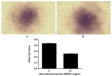 Human Gremlin 1 protein, His tag (active). GTX00209-pro