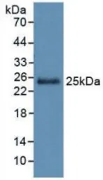 Human Gremlin 1 protein, His tag (active). GTX00210-pro
