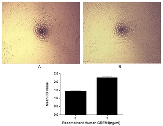 Human Gremlin 1 protein, His tag (active). GTX00210-pro