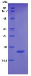 Human Angiopoietin 2 protein, His tag. GTX00212-pro