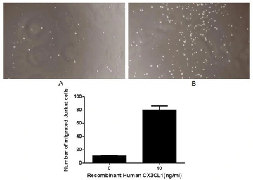 Human CX3CL1 protein, His tag (active). GTX00214-pro