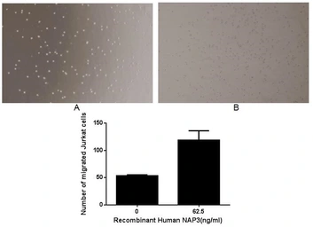 Human CXCL1 / GRO alpha protein, His and GST tag (active). GTX00215-pro