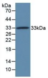Human alpha Taxilin protein, His tag. GTX00218-pro