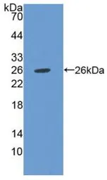 Human CHI3L1 protein, His tag (active). GTX00219-pro