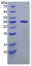 Human CHI3L1 protein, His tag (active). GTX00219-pro