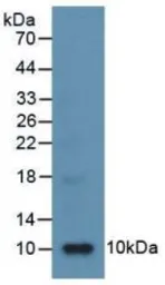 Human CXCL8 / IL8 protein, His tag (active). GTX00228-pro