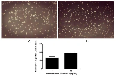 Human CXCL8 / IL8 protein, His tag (active). GTX00228-pro