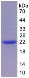 Human IGFBP3 protein, His tag. GTX00231-pro