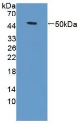 Human TNF Receptor I protein, His and GST tag (active). GTX00234-pro
