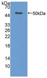 Human TNF Receptor II protein, His tag (active). GTX00235-pro