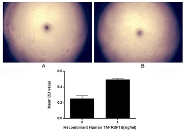 Human TNF Receptor II protein, His tag (active). GTX00235-pro