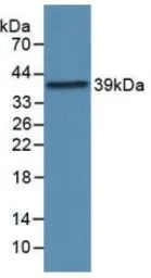 Human Prokineticin 2 protein, His and GST tag (active). GTX00253-pro