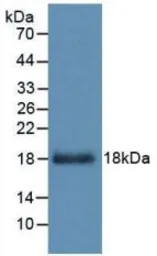 Human FGF23 protein, His tag. GTX00257-pro
