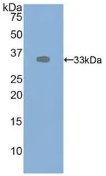 Human VEGF Receptor 2 protein, His tag (active). GTX00258-pro