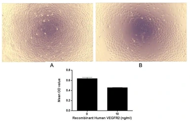 Human VEGF Receptor 2 protein, His tag (active). GTX00258-pro