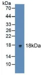Human IL2 protein, His tag (active). GTX00265-pro