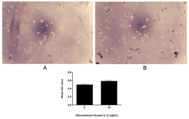 Human IL2 protein, His tag (active). GTX00265-pro