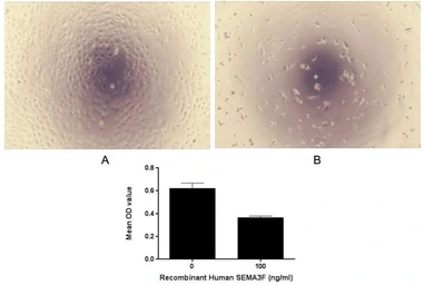 Human SEMA3F protein, His tag (active). GTX00267-pro