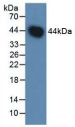 Human Factor B (Ba fragment) protein, His and GST tag (active). GTX00269-pro