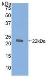 Human Cofilin 1 protein, His tag. GTX00270-pro