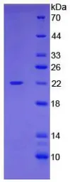 Human Cofilin 1 protein, His tag. GTX00270-pro
