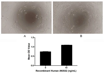 Human Annexin II protein, His tag (active). GTX00273-pro