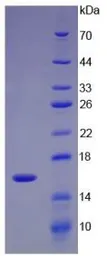 Human UGCG protein, His tag. GTX00280-pro