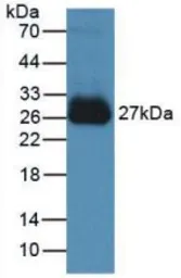 Mouse IL6 protein, His tag (active). GTX00286-pro