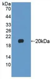 Mouse FGF22 protein, His tag (active). GTX00299-pro