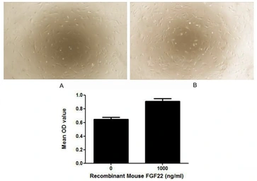 Mouse FGF22 protein, His tag (active). GTX00299-pro