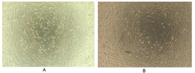 Mouse Reg3B protein, His tag (active). GTX00307-pro