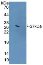 Mouse Gremlin 1 protein, His tag (active). GTX00318-pro
