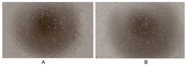 Mouse PF4 protein, His tag (active). GTX00334-pro