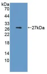 Rat IL6 protein, His tag (active). GTX00341-pro