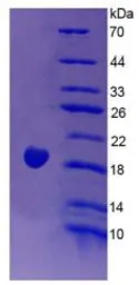 Rat Endothelin 1 protein, His tag (active). GTX00345-pro