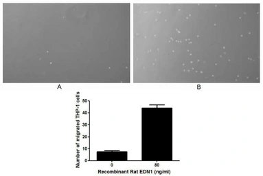 Rat Endothelin 1 protein, His tag (active). GTX00345-pro