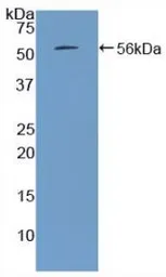 Rat Parathyroid Hormone protein, His and MBP tag (active). GTX00348-pro