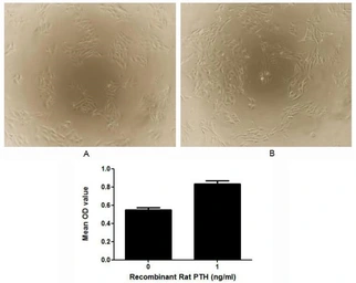 Rat Parathyroid Hormone protein, His and MBP tag (active). GTX00348-pro