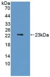 Rat FGF13 protein, His tag (active). GTX00350-pro