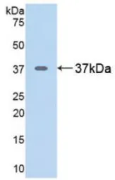Rat Arginase 1 protein, His tag. GTX00359-pro