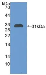 Rat CHI3L1 protein, His tag (active). GTX00364-pro