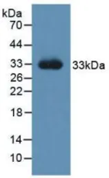 Rat NGF protein, His tag (active). GTX00371-pro