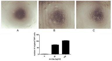 Human C5a protein, His and Fc tag (active). GTX00416-pro