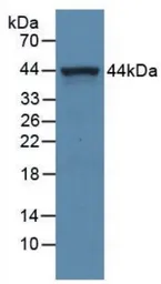 Human C5a protein, His and Fc tag (active). GTX00416-pro
