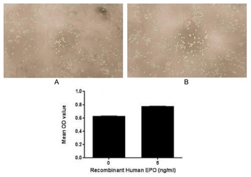 Human EPO protein, His and GST tag (active). GTX00422-pro