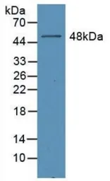 Human EPO protein, His and GST tag (active). GTX00422-pro
