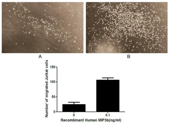 Human MIP3 beta protein, His tag (active). GTX00424-pro