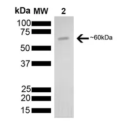 Human HSP60 protein, His tag (active). GTX00440-pro