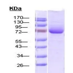 Human Hsp70 protein, His tag (active). GTX00448-pro