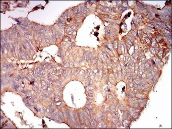 Anti-Syndecan-1 / CD138 antibody [1A3H4] used in IHC (Paraffin sections) (IHC-P). GTX00451
